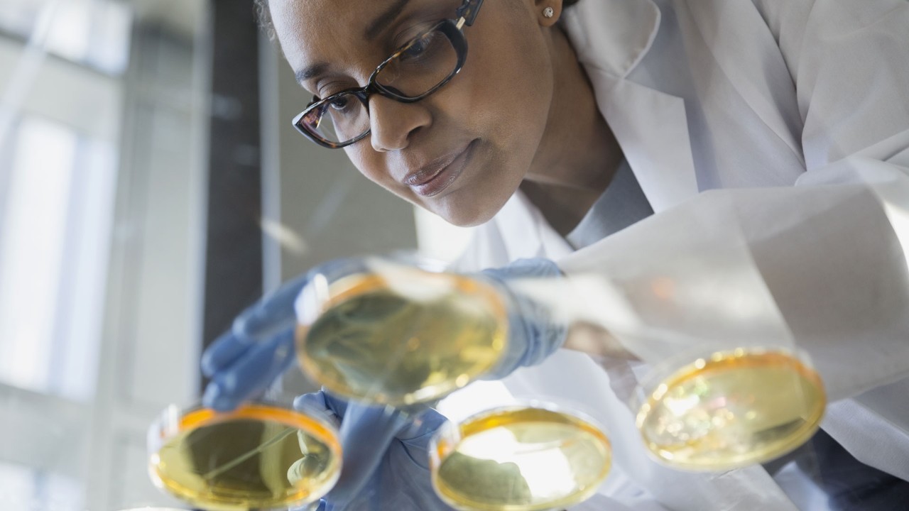 scientist working with petri dishes