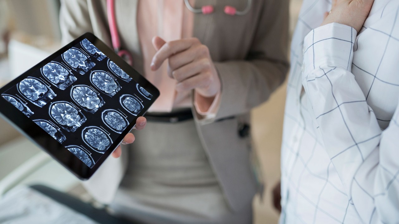 doctor showing patient brain scans