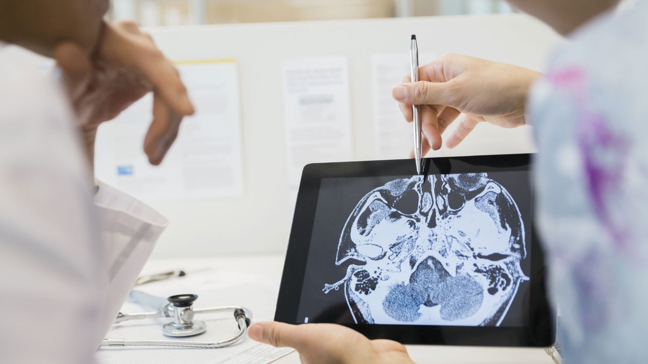 two people looking at an MRI scan of a brain